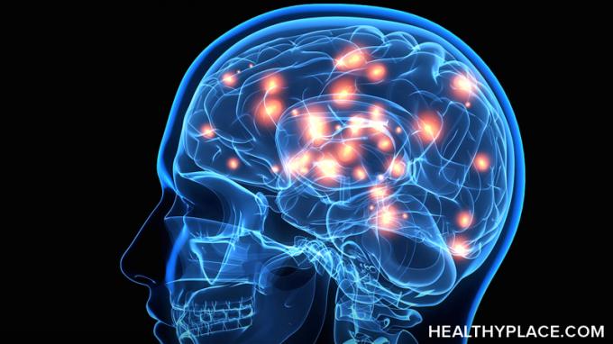 En quoi le cerveau de la maladie de Parkinson est-il différent? Découvrez comment Parkinson affecte le cerveau et ce qui apparaît sur un scanner cérébral, ici à HealthyPlace. 