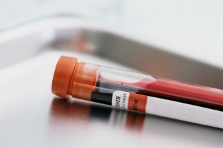 Récemment, un test sanguin a été annoncé pour prédire l'augmentation du risque de suicide, mais pouvons-nous vraiment prédire le risque de suicide avec un simple test sanguin?