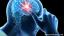 Ce qu'il faut savoir sur l'épilepsie et la santé mentale